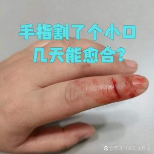 切完南瓜手指皮紧绷怎么回事_切南瓜手皮紧绷怎么办？