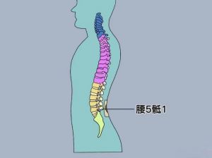 腰五骶一精准位置图_触摸找L4L5，腰痛勿忽视