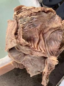 牛腩煮了20分钟会熟吗_高压锅炖牛腩20分钟熟透，普通锅需40分钟以上