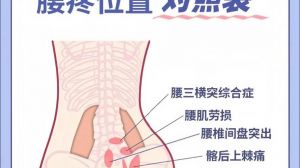 腰部疼痛9位置图_腰部疼痛部位不同，原因也不同