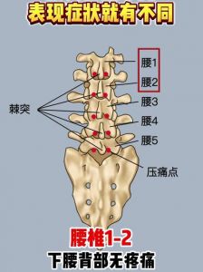 腰5骶1椎位置图片_睡姿正确+好习惯，告别腰腿痛