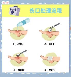 刀伤处理的正确方法_刀伤急救处理及预防小知识