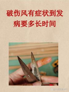 破伤风自测15秒方法_深窄伤口易得破伤风，及时就医很重要！