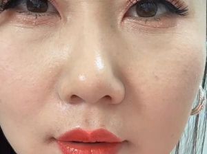 油脸盯射挑战最简单三个步骤_控油疏通是关键，选对清爽产品是王道！