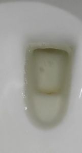 不到30分钟就想上小便白色_尿频尿白？可能是前列腺炎或其他问题