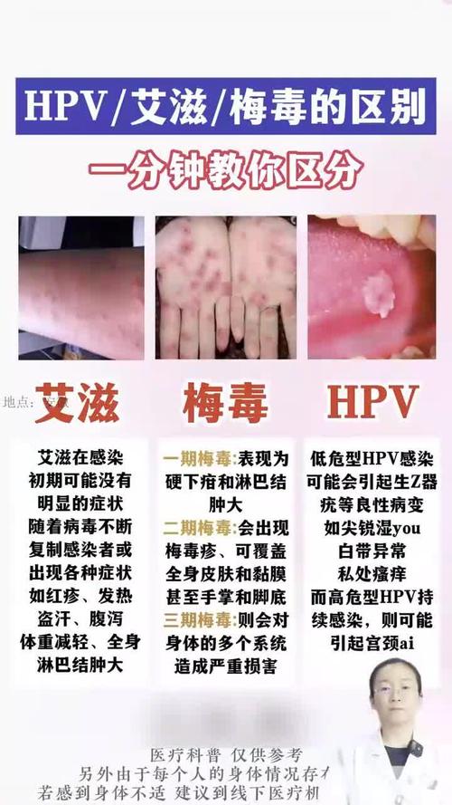 硬下疳最简单辨别方法图片_不痛小疙瘩易忽视