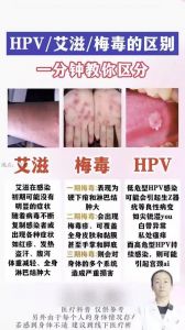硬下疳最简单辨别方法图片_不痛小疙瘩易忽视