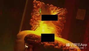 重口脱垂改造最简单三个步骤_提肛运动助盆底，纤维水分好习惯