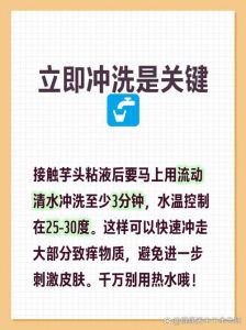 芋头汁弄手上痒怎么办_芋头汁手痒？冷水洗，醋泡，姜擦，药膏缓解！