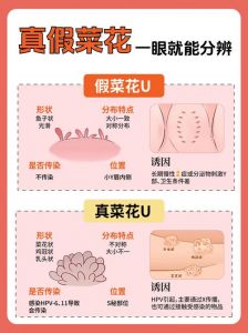 氽与焯的区别_烹饪技法大不同