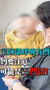 三凹征凹陷的三个部位是_三凹征是啥？呼吸困难时胸骨上窝锁骨上窝和肋间隙凹陷