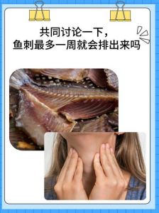 鲤鱼哪个部位刺少_鲤鱼少刺鲜美，红烧糖醋味更佳