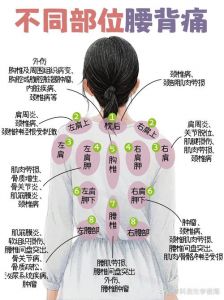 腰五骶一位置图解_腰四五椎间盘问题多，注意姿势别久坐