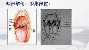 采集咽拭子的正确方法_仰头张嘴，擦拭扁桃体后壁，规范操作保质量