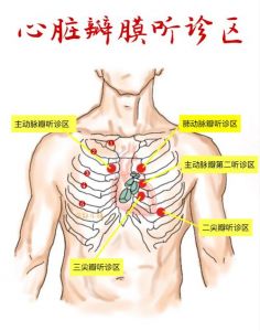 心脏听诊部位5个示意图_五区定位听心音，助判病情