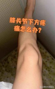 膝盖骨下方不适是什么部位_膝盖下方疼？快查查是啥原因！