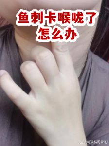 卡鱼刺多久能自己烂_深浅不同，处理方式有别