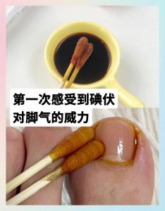 碘伏的正确使用方法_碘伏正确使用方法及注意事项