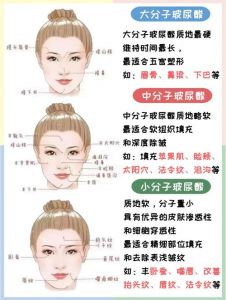 全脸除皱包括哪些部位_除皱恢复期避讳表情，眉眼法令纹处理需谨慎