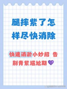 摔出淤青怎么处理_摔伤淤青怎么处理？分时应对法
