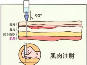 羊肌肉注射部位图解_羊打针部位操作全攻略