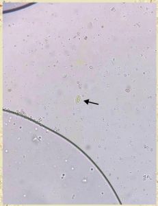 蓝氏贾第鞭毛虫的形态有哪些_鬼脸滋养体与椭圆形包囊，粪口传播要预防
