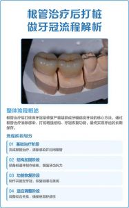 打桩做牙冠步骤_从取模到粘接全解析