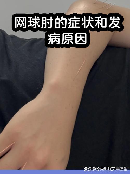 肘腕是哪个部位图片_了解其结构，平衡运动与休息