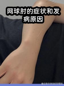 肘腕是哪个部位图片_了解其结构，平衡运动与休息