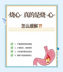胃烧心最快的解决方法_胃烧心怎么办？简单缓解方法！