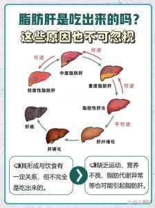 鹅肝是鹅喂出来的脂肪肝吗_法国名菜，奢华但也需理性尝鲜